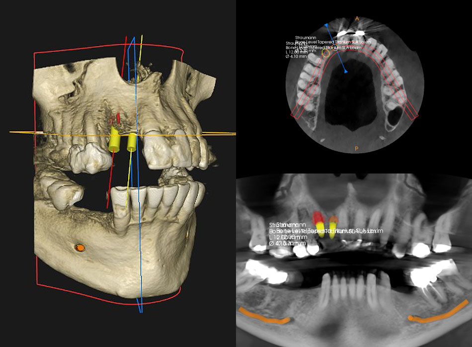 Bramley Dental Practice - Patient CT Scan